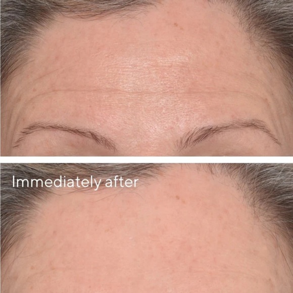 Murad Targeted Wrinkle Corrector - Picture 2 of 3